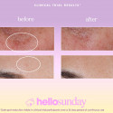 Näo seerum Hello Sunday The One That Makes You Glow Dark Spot SPF 40 (30 ml)