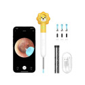 Smart Visual Ear-Clean Rod Xlife Q3 (yellow)