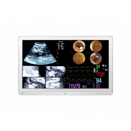 "LG 32HL714S-W80,01cm31,5Zoll TFT 16:9 800cd/m 3840x2160 5ms"